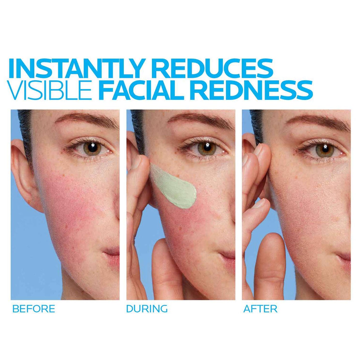 toleriane-rosaliac-ar-face-cream-for-visible-redness-x1 8_Toleriane_Rosaliac-AR-before-after.jpg