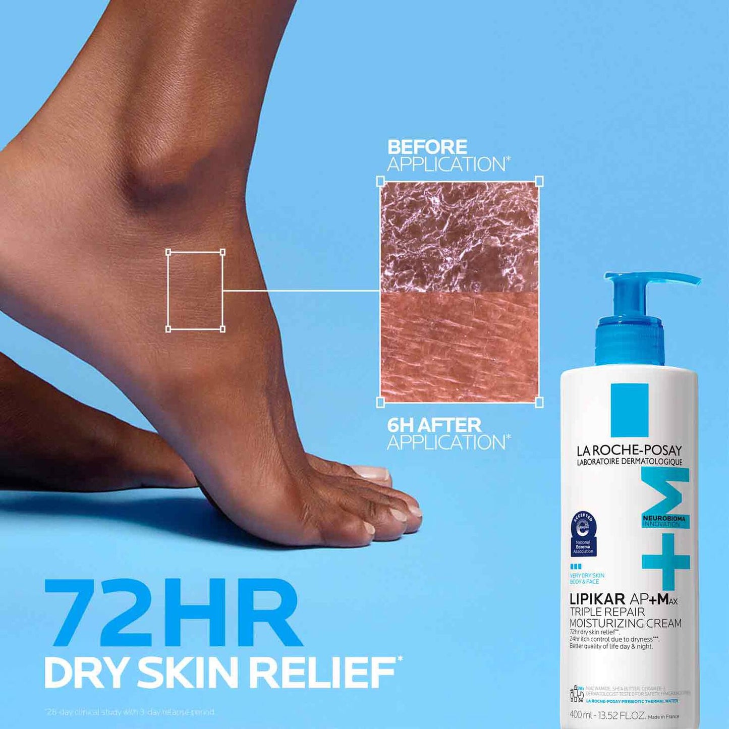 lipikar-ap-max-triple-repair-moisturizing-cream-y1 LaRochePosay-Product-Skincare-Lipikar-Balm-AP+MAX-400ml-3337875941150-ATF-PIM-BeforeAfter.jpg