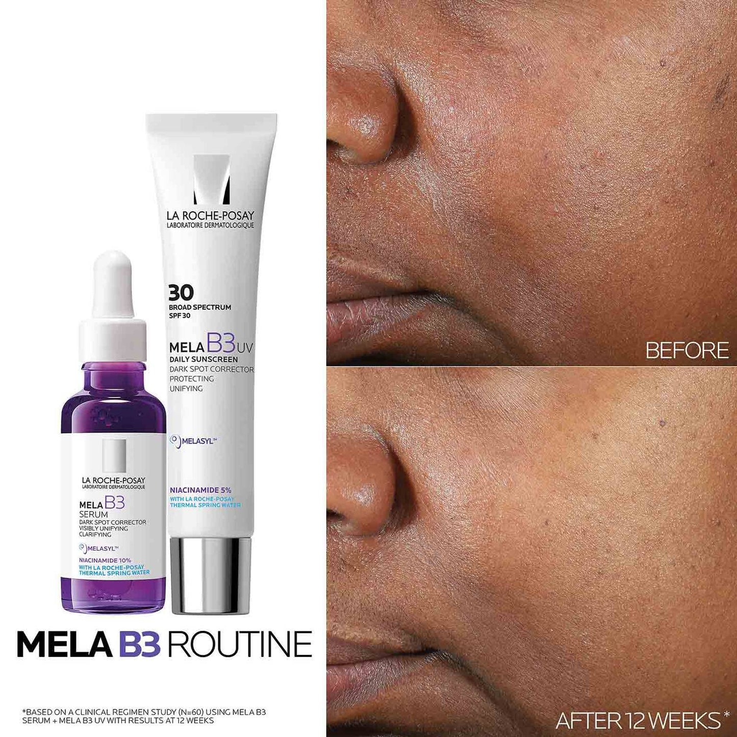 mela-b3-dark-spot-serum-with-melasyltm-niacinamide-b8 Mela-B3-routine_1500X1500.jpg